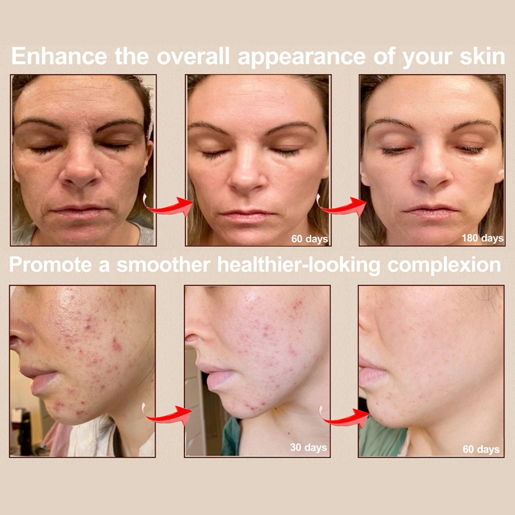 RadiancePro™ Neck & Face Mask